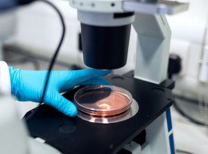 Demodex skin mites hitch rides to the lab in pathology samples. Photo by ThisisEngineering RAEng on Unsplash.