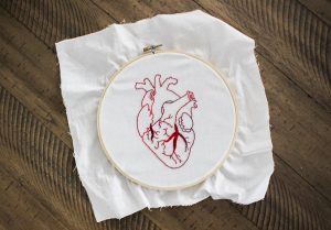 heart attack and cardiac arrest