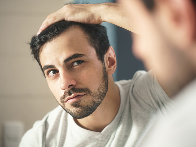 Man checks hairline in the mirror for hair loss. 