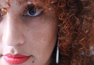 Close up of woman with melasma.